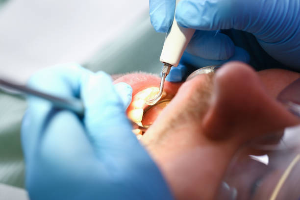Best Emergency Dentist for Knocked-Out Tooth in Byram Center, NJ