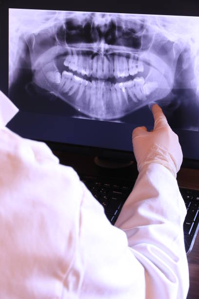 Best Emergency Dentist for Lost Fillings or Crowns in Byram Center, NJ