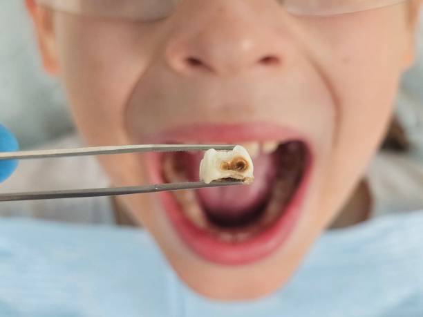 Best Emergency Dentist for Special Needs Patients in Byram Center, NJ