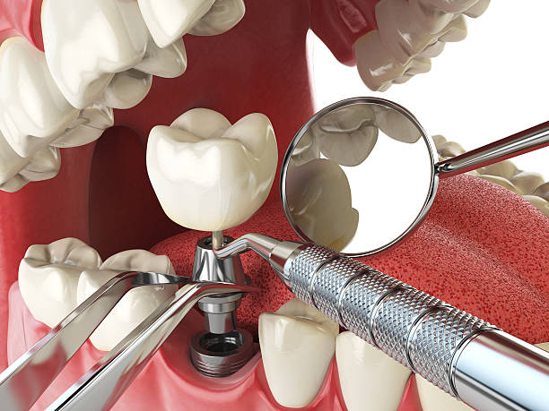 Best Mobile Emergency Dentist in Byram Center, NJ